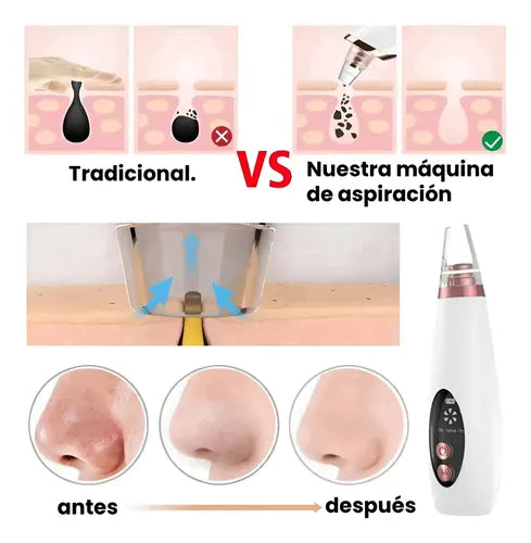 Limpiador Puntos Negros Exfoliador Rosa