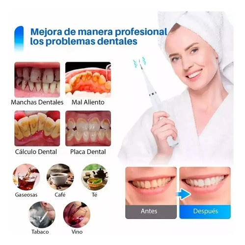 Cepillo Dientes Electrico Usb Y Removedor De Sarro Con Acc.