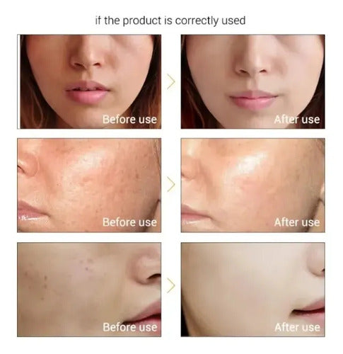 Serum Lanbena Vitamina C para Pecas y Manchas 15 ml · 17139 · foto 08