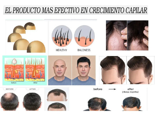 Para Combatir La Caida Del Pelo Super Efectivo Cell Active