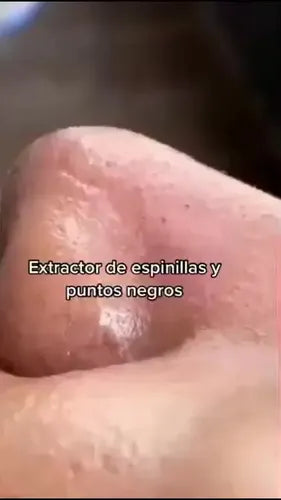 Limpiador Puntos Negros Exfoliador Rosa