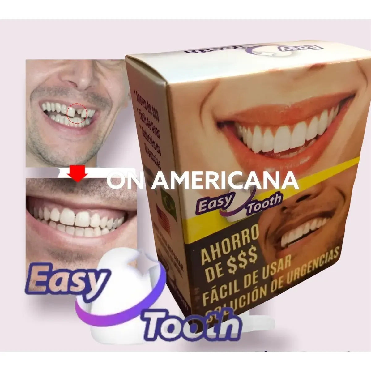 Kit Diente Provisorio Para Reemplazar Un Diente Easy Tooth