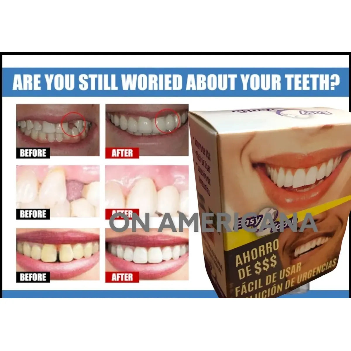 Kit Diente Provisorio Para Reemplazar Un Diente Easy Tooth