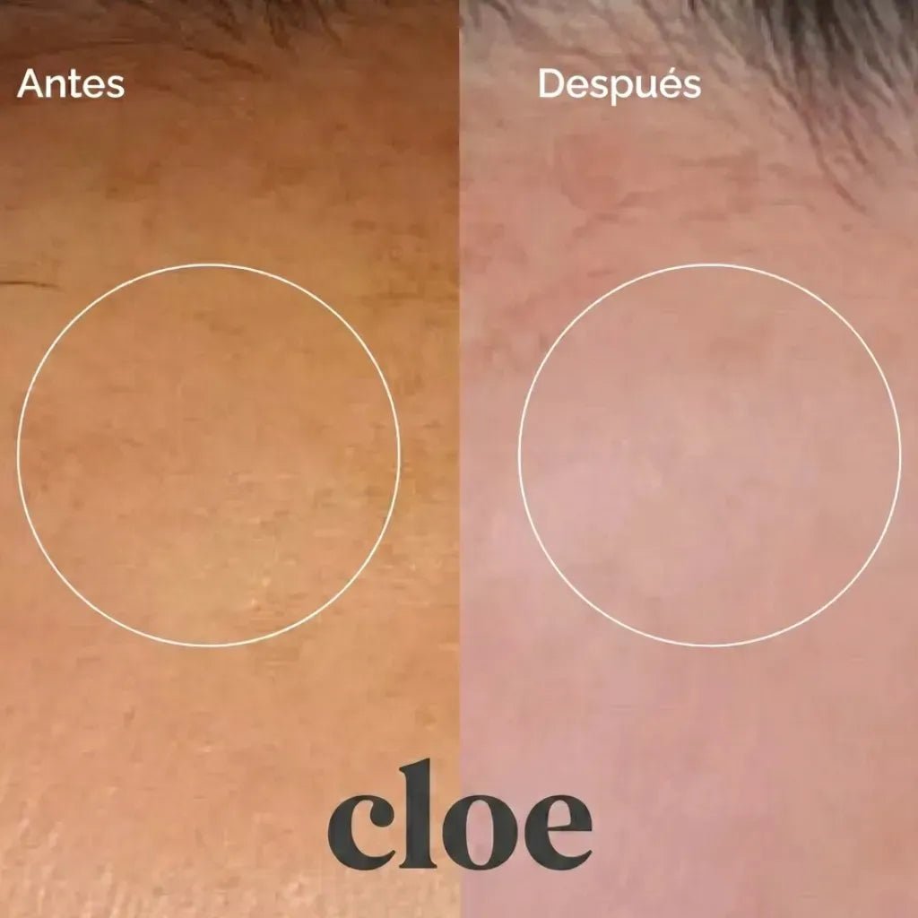 Loción Exfoliante Antimancha Con Ácido Glicólico Cloe 75 Ml