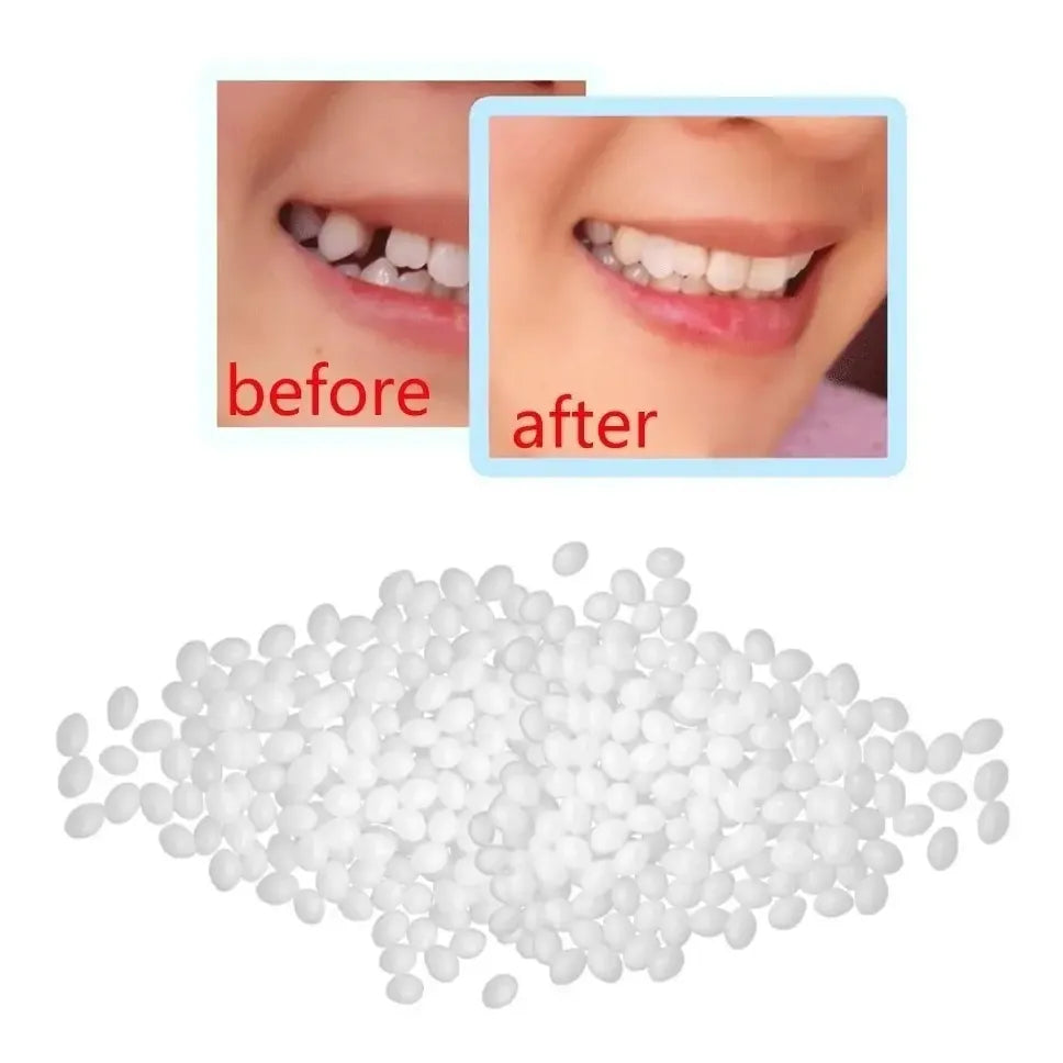 Kit Diente Provisorio Para Reemplazar Un Diente Easy Tooth