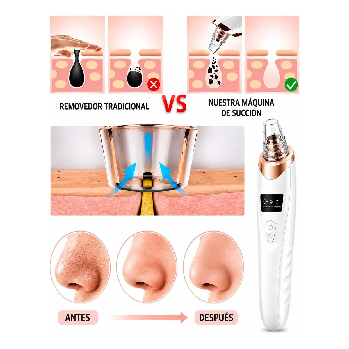 Extractor Puntos Negros Y Espinillas Usb + Set Removedor
